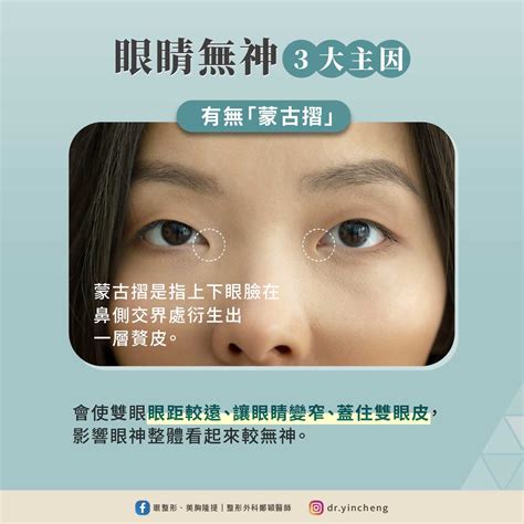 戴眼鏡眼睛會變小嗎|整形外科 鄭穎醫師